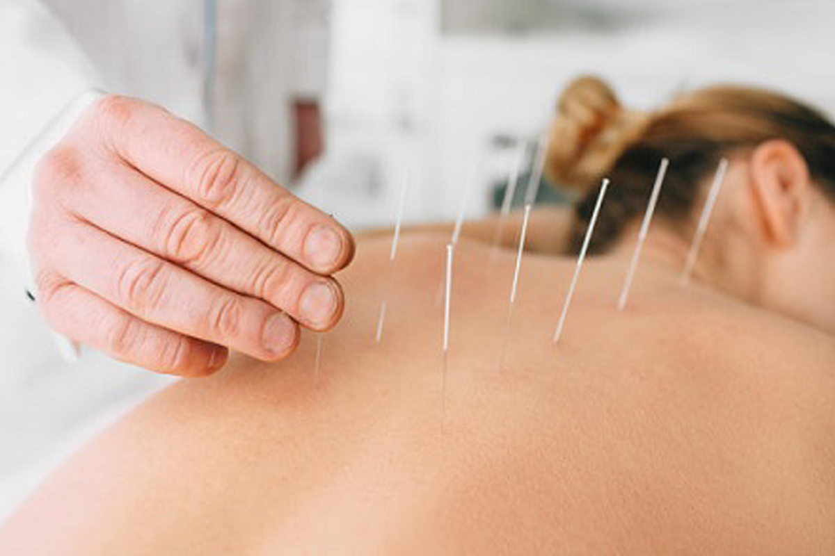https://www.naturomedical.com/wp-content/uploads/2020/09/Acupuncture-Procedures-updated.png