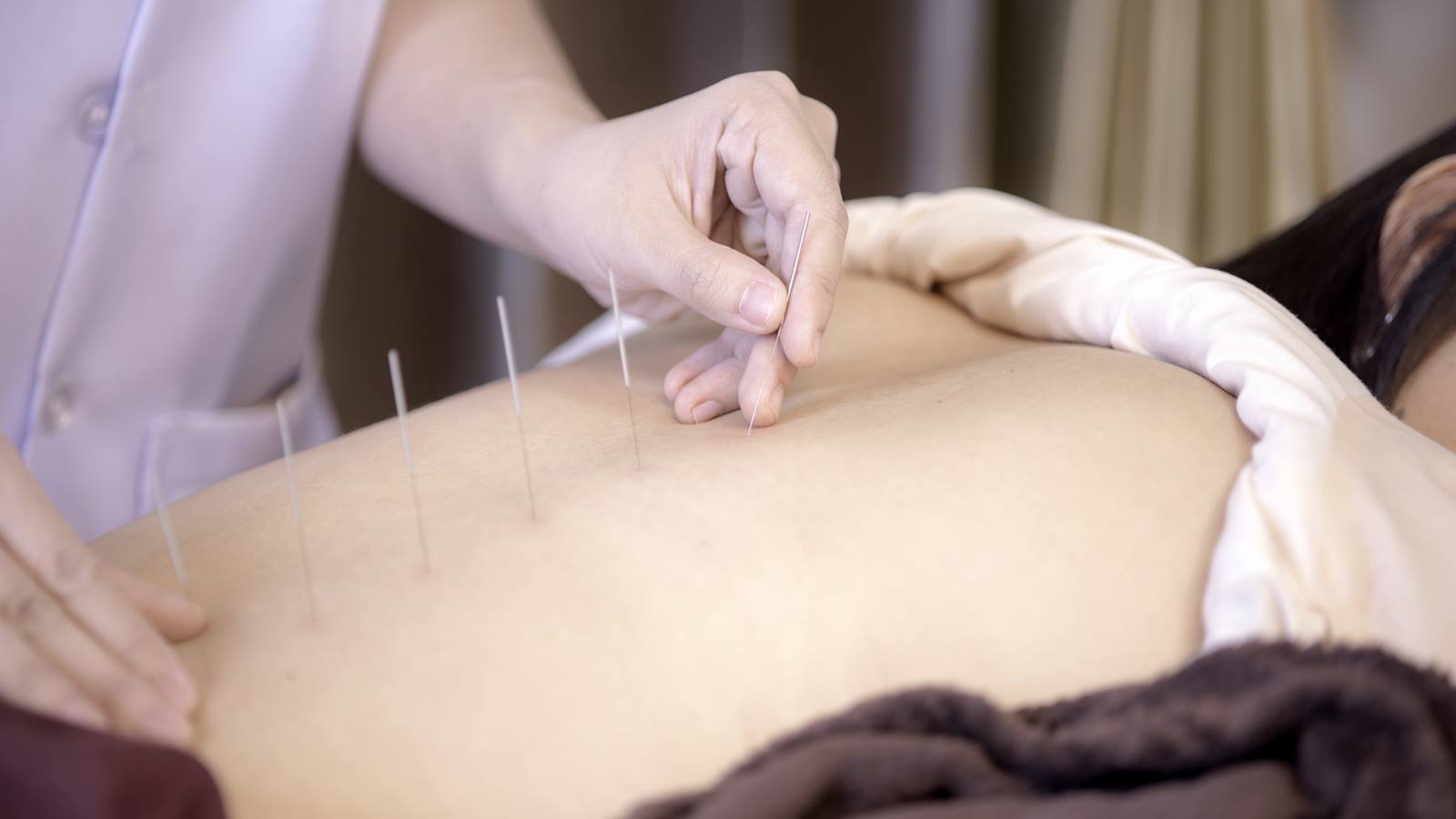 https://www.naturomedical.com/wp-content/uploads/2020/09/Why-I-Love-Acupuncture.jpg