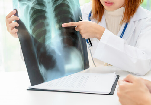 https://www.naturomedical.com/wp-content/uploads/2020/09/X-ray-ECG-2.jpg